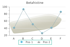 purchase 16 mg betahistine visa