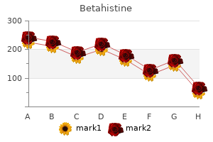buy betahistine 16mg without a prescription
