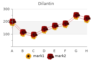 generic dilantin 100mg with mastercard