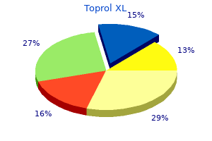 buy toprol xl with mastercard