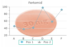 best buy fertomid