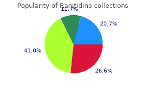 purchase ranitidine 150mg free shipping