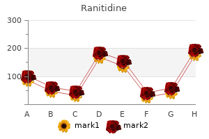 order 150mg ranitidine with mastercard