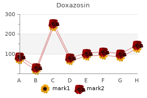cheap 1mg doxazosin with mastercard