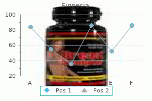 finpecia 1 mg lowest price