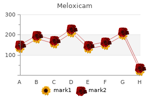 purchase meloxicam 15mg line