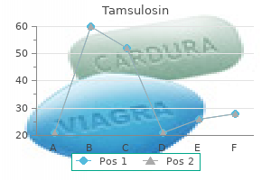 tamsulosin 0.2mg with mastercard