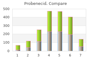 purchase probenecid uk
