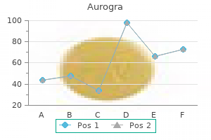 purchase 100 mg aurogra mastercard
