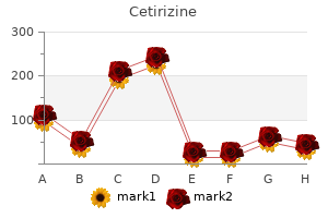buy cetirizine without a prescription