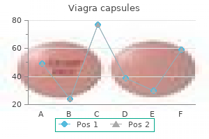 purchase genuine viagra capsules on line