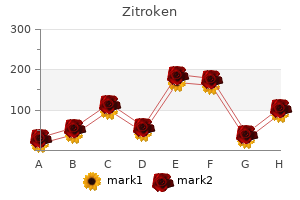 best buy zitroken