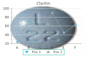 purchase 10mg claritin fast delivery