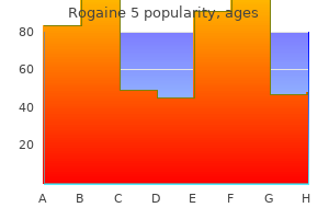 generic rogaine 5 60 ml with mastercard