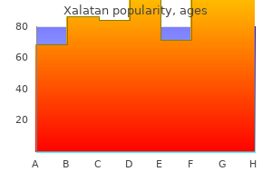discount xalatan 2.5 ml amex